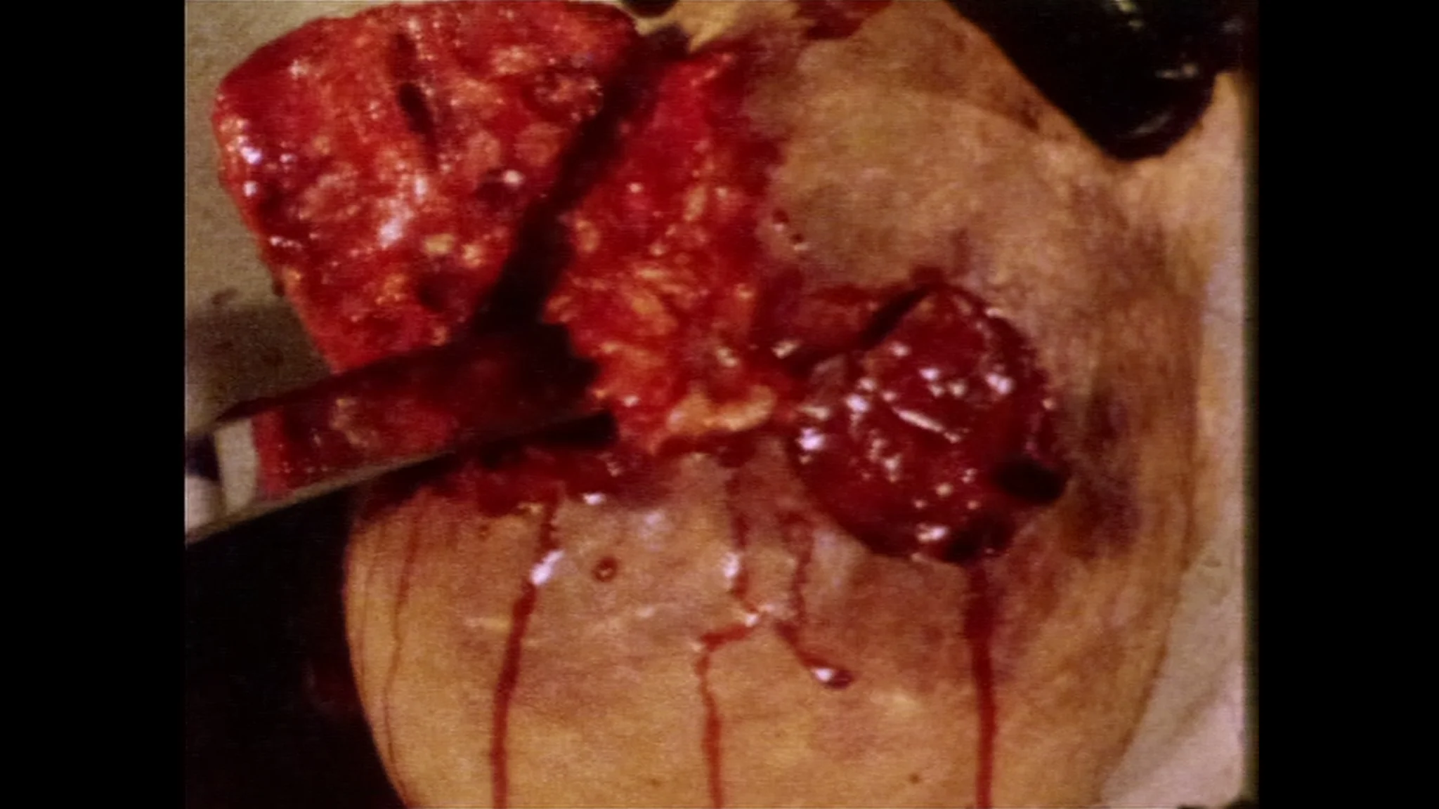5 Dead on the Crimson Canvas - Image 17